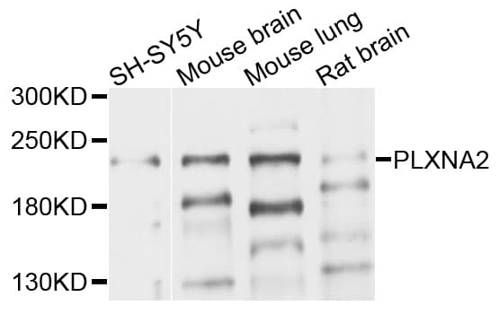 PLXNA2 / Plexin A2 Antibody
