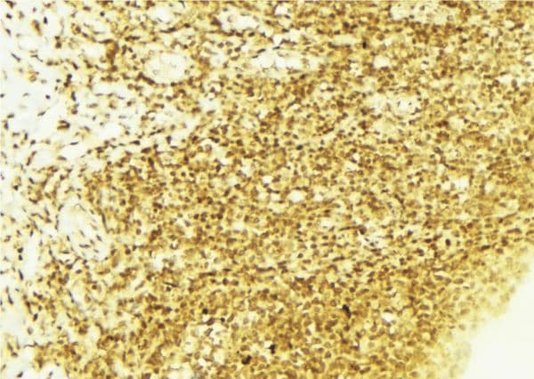 Polyclonal Rabbit anti-Human STK11 / LKB1 Antibody (phospho-Ser428, IHC, IF, WB)