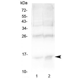 Polyclonal Rabbit anti-Human HBA1+2 / Hemoglobin Alpha Antibody (IHC, WB)