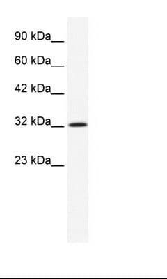 ANXA1 / Annexin A1 Antibody (N-Terminus)
