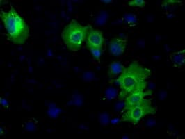 PRKAR2A Antibody (clone OTI1G7)