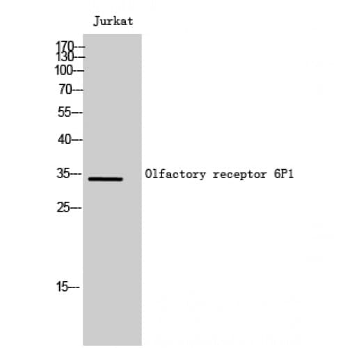 Polyclonal Rabbit anti-Human OR6P1 Antibody (130-210 aa, Internal, IF, WB)