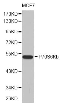 RPS6KB2 / S6K2 Antibody