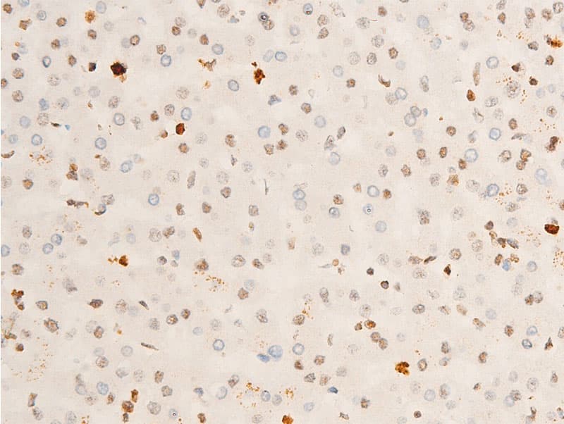 Polyclonal Rabbit anti-Human NTRK1 / TrkA Antibody (phospho-Tyr680,phospho-Tyr681, IHC, WB)