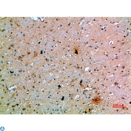 Polyclonal Rabbit anti-Human PDGF-CC Antibody (IHC)