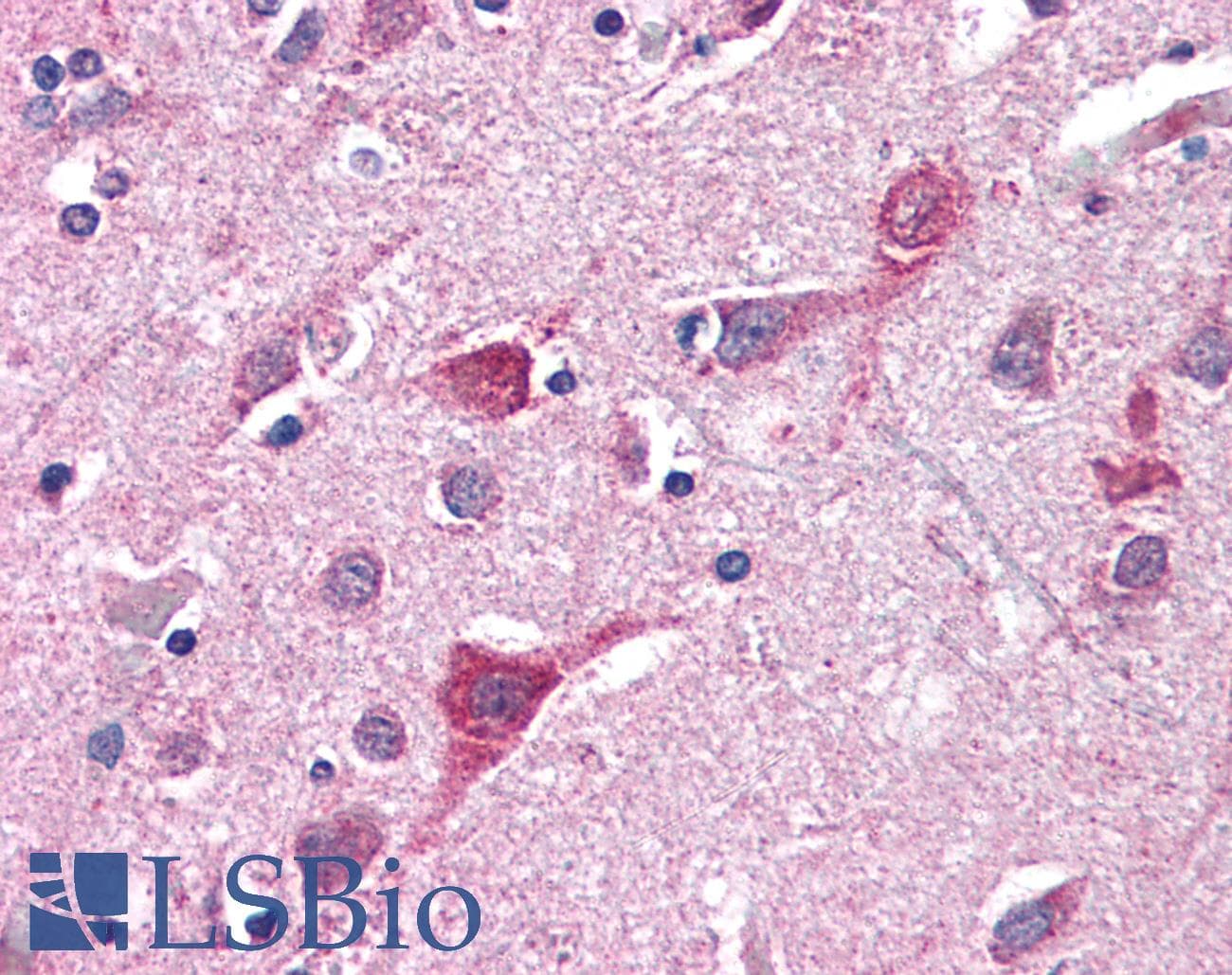 IHC-plus™ TOMM70A Antibody (aa1-100)