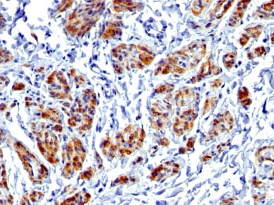 CALD1 / Caldesmon Antibody (clone CALD1/1424R, Azide-free, Carrier-free)