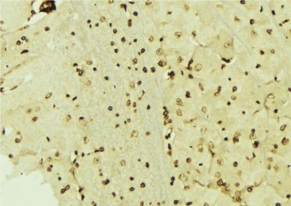 Polyclonal Rabbit anti-Human CSRP1 Antibody (IHC, WB)