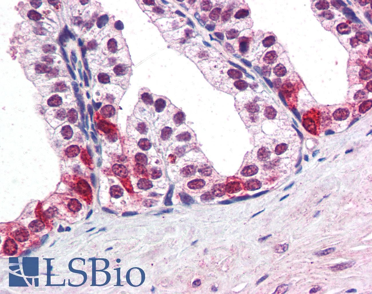 IHC-plus™ SMARCE1 / BAF57 Antibody (aa364-376)