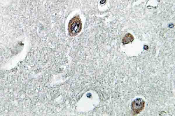 NDUFB10 Antibody (Glu95)