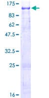 Human REPS1 Protein (Recombinant GST)