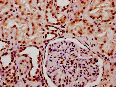 Polyclonal Rabbit anti-Human HIST1H2BN Antibody (IHC, IF)