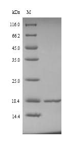 Salmonella typhi uspA Protein (Recombinant 6His, N-terminus)