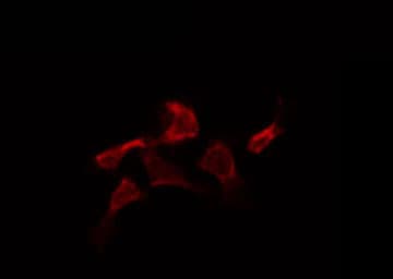 CASP2 / Caspase 2 Antibody