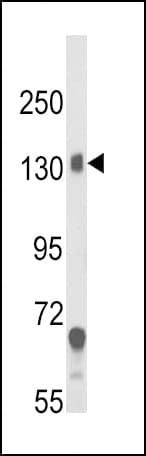 CACNA2D1 Antibody (aa47-76)