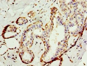 Polyclonal Rabbit anti-Human APBB1IP / RIAM Antibody (aa1-150, IHC, WB)