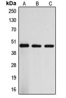 IHC-plus™ ARRDC3 Antibody (C-Terminus)