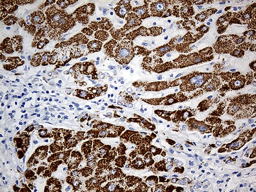 P5CDH / ALDH4A1 Antibody (aa1-503, clone OTI1H10)