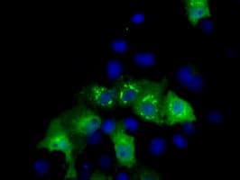 Monoclonal Mouse anti-Human MCL1 / MCL 1 Antibody (clone OTI4B7, IHC, IF, WB)