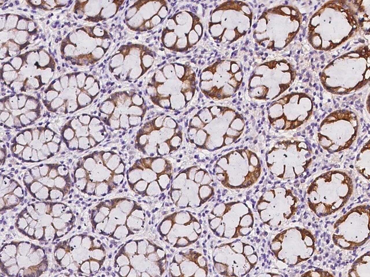 Polyclonal Rabbit anti-Human RET Antibody (IHC)