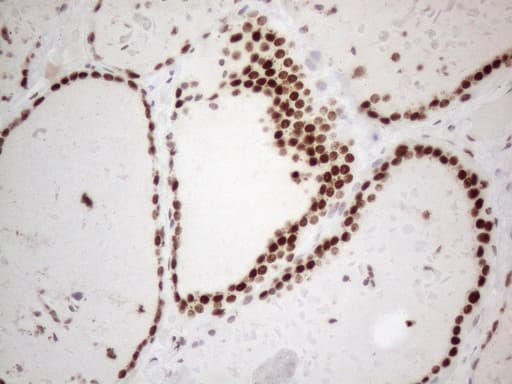 HNRNPL / hnRNP L Antibody (aa270-502, clone OTI4E5, Carrier-free)