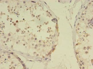 RBMY1F Antibody (aa1-496)