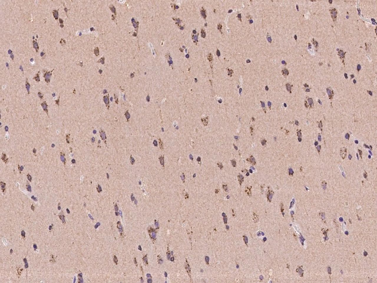 MAN2A2 / Alpha-Mannosidase II Antibody