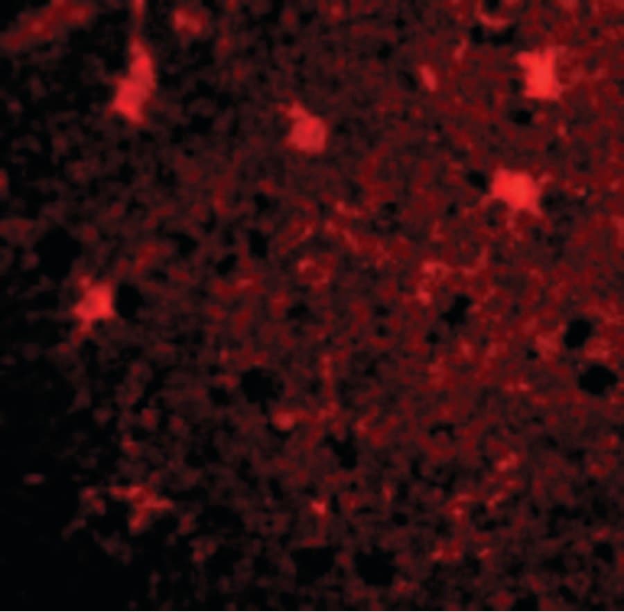 IHC-plus™ BRCC3 / BRCC36 Antibody