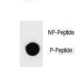 Hamartin / TSC1 Antibody (phospho-Thr417)