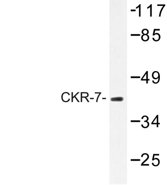 CCR7 Antibody (Arg209)