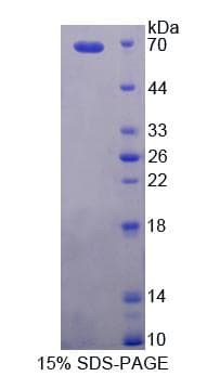 Human PCYOX1 Protein (Recombinant His-GST)