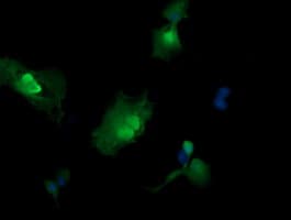MAP2K3 / MEK3 / MKK3 Antibody (clone OTI5D3, Carrier-free)
