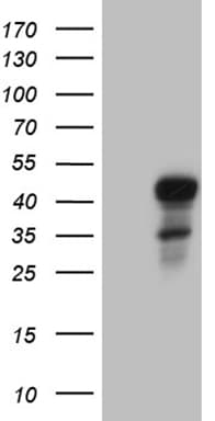 ELF3 / ESE1 Antibody (aa175-286, clone OTI6G6)