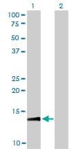 RPA3 Antibody (clone 1F4)