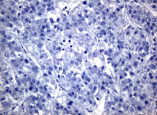 Monoclonal Mouse anti-Human KRT19 / CK19 / Cytokeratin 19 Antibody (clone UMAB3, aa240-390, IHC, IF, WB)