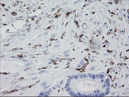 F13A1 / Factor XIIIa Antibody (clone OTI9E2)
