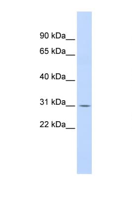 Polyclonal Rabbit anti-Human NFKBIA / IKB Alpha / IKBA Antibody (N-Terminus, WB)