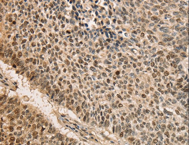 CDCA8 / Borealin Antibody
