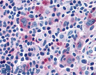 PathPlus™ Polyclonal Rabbit anti-Human CCR7 Antibody (Extracellular Domain, IHC)
