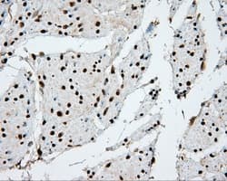 APP / Beta Amyloid Precursor Antibody (clone OTI2B10)