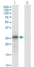 Monoclonal Mouse anti-Human KLK6 / Kallikrein 6 Antibody (clone 4A10, WB)