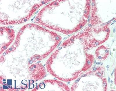 IHC-plus™ BOLA3 Antibody