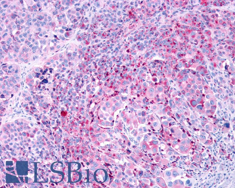 PathPlus™ Polyclonal Rabbit anti-Human LPAR3 / LPA3 / EDG7 Antibody (Cytoplasmic Domain, IHC)