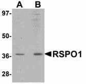 RSPO1 / RSPO Antibody