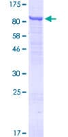 Human TTC30A Protein (Recombinant GST)