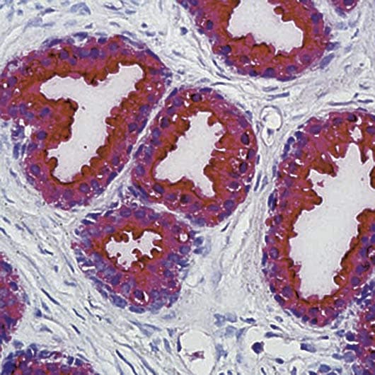 ACPP / PAP Antibody (clone PASE/4LJ)