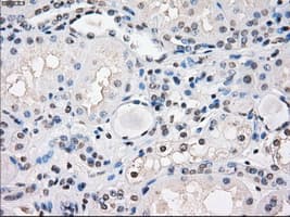 FRA-1 / FOSL1 Antibody (clone OTI12F9)
