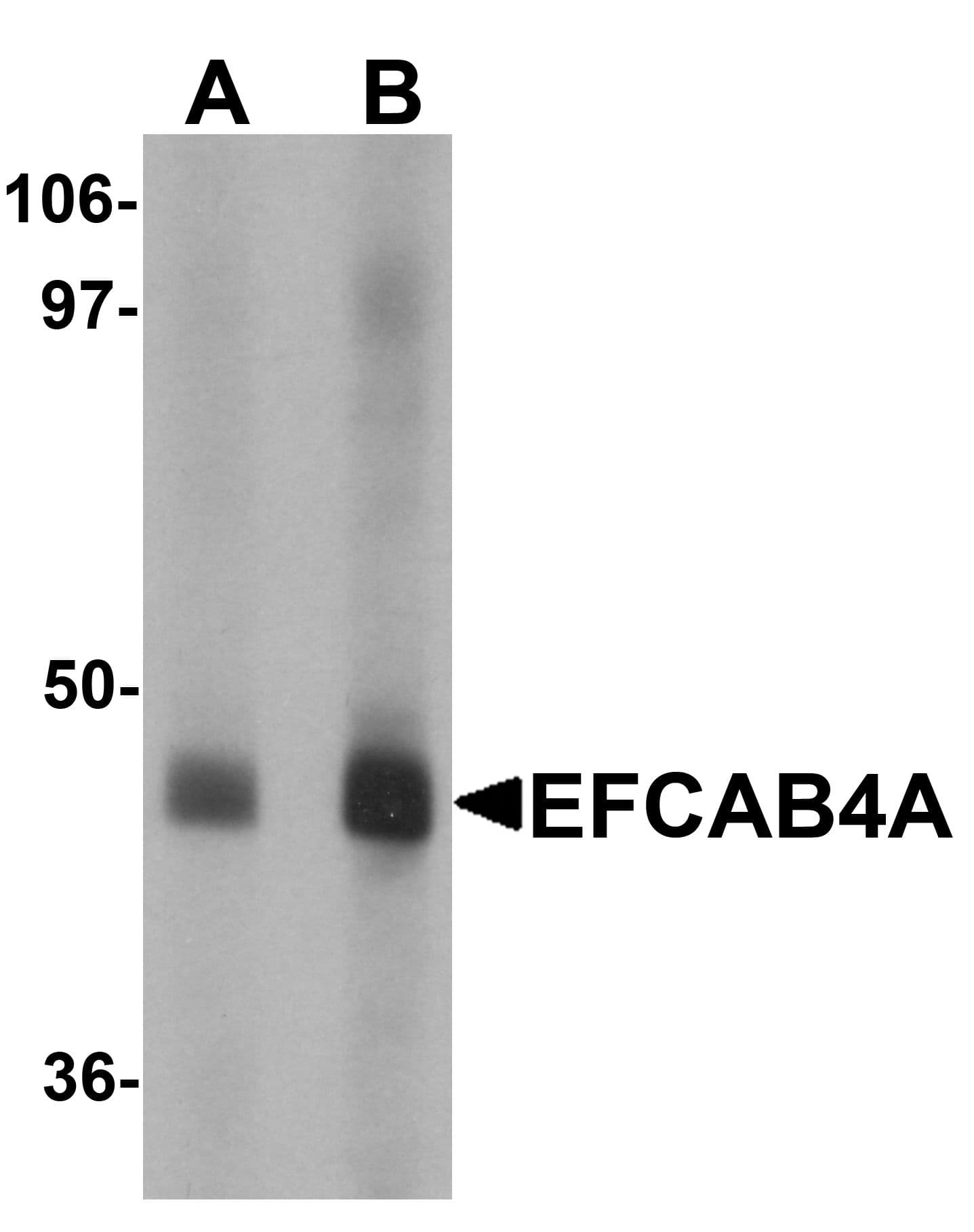 IHC-plus™ Polyclonal Rabbit anti-Human CRACR2B / EFCAB4A Antibody (IHC, WB)
