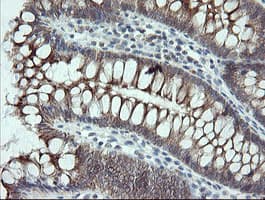 VBP1 Antibody (clone OTI2E6)