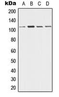 DSG3 / Desmoglein 3 Antibody (Internal)
